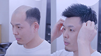 男士禿頂假發(fā)案例視頻>>
