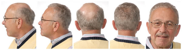 ���L(f��ng)�ɼٰl(f��) ���l(f��)�a(b��)�l(f��) ����