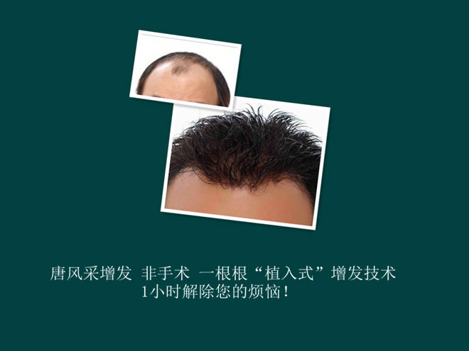 �ٰl(f��) ���L(f��ng)��