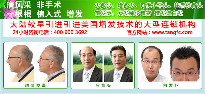 唐風(fēng)采假發(fā)技術(shù) 解決三千煩惱 唐風(fēng)采假發(fā)技術(shù) 解決三千煩惱