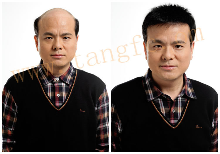 吃什么對(duì)頭發(fā)好 吃什么對(duì)頭發(fā)好