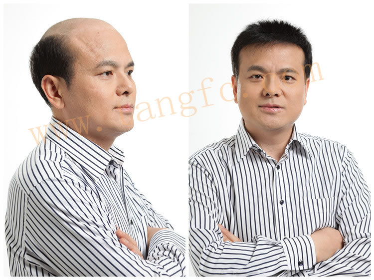 脫發(fā)原因及預防脫發(fā) 脫發(fā)原因及預防脫發(fā)