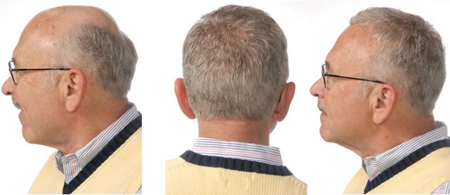 ���H��(ji��)�����L(f��ng)�ɼٰl(f��)׌���H��eÓ�l(f��)�װl(f��)