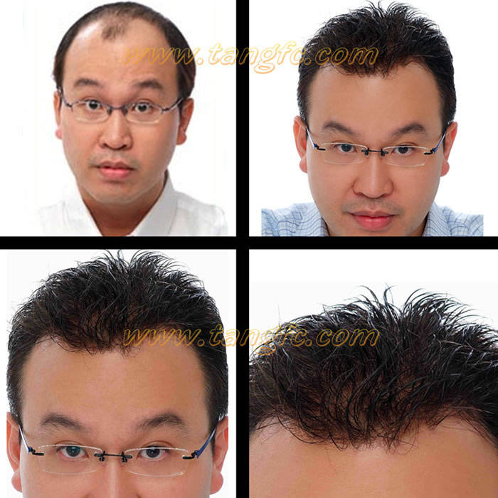 頭發(fā)脫落的原因 \