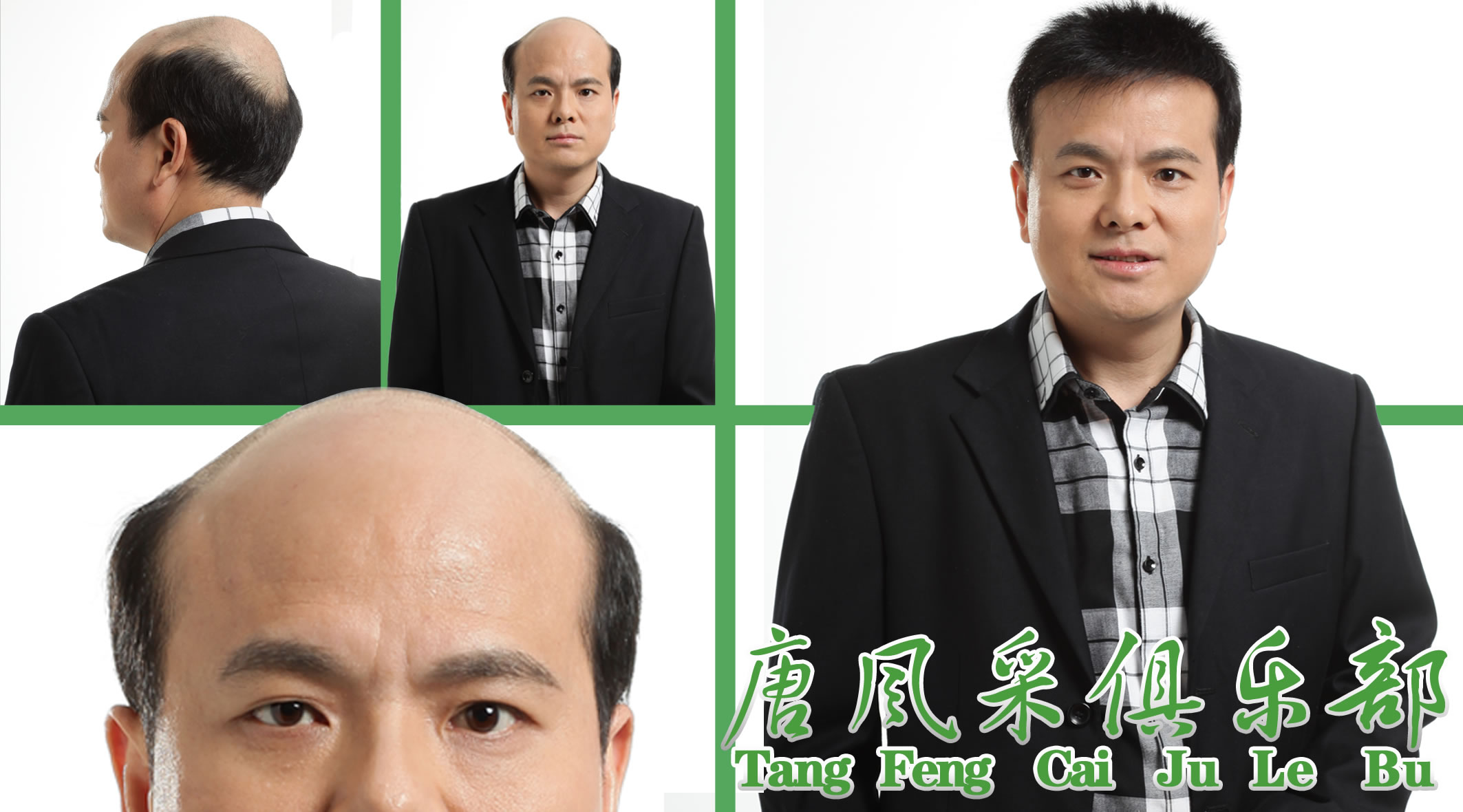 假發(fā)、跟織發(fā)有什么區(qū)別