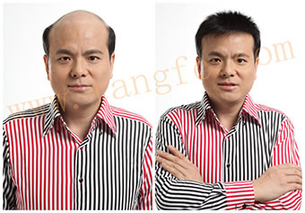 織發(fā)都有哪些優(yōu)勢 表現(xiàn)在哪些方面？