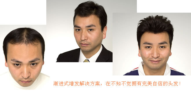 怎么洗頭才不容易脫發(fā)？