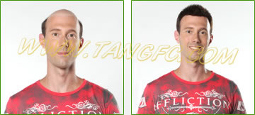 請(qǐng)問(wèn)織發(fā)跟假發(fā)有什么區(qū)別么？