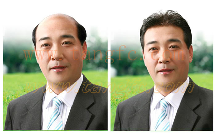 男士織發(fā)效果好么？怎么樣？