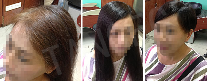 頭發(fā)變濃密效果 \