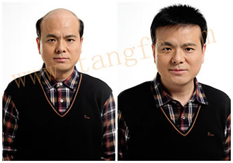 廣州哪里有唐風(fēng)采假發(fā)？