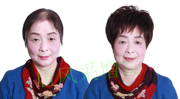 �z���԰װl(f��)