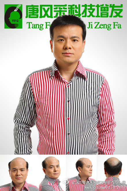 增城織發(fā)補(bǔ)發(fā)哪里好？