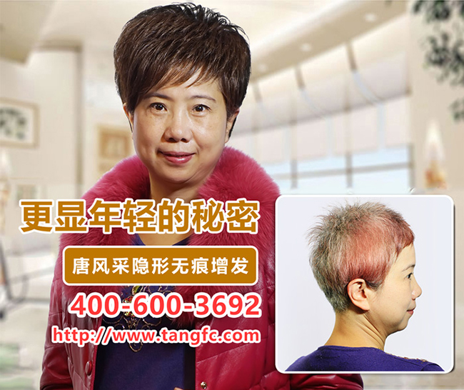 頭頂部頭發(fā)稀疏，究竟什么原因造成的？