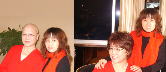 女性頭發(fā)稀疏謝頂怎么辦？如果發(fā)體稀疏就要避免這些！