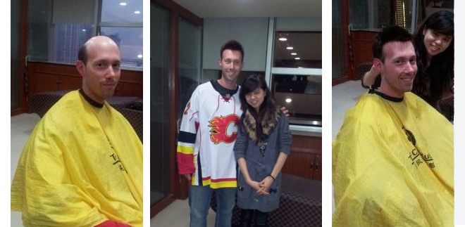 先天性頭發(fā)稀少能治嗎？找對(duì)方法才是關(guān)鍵