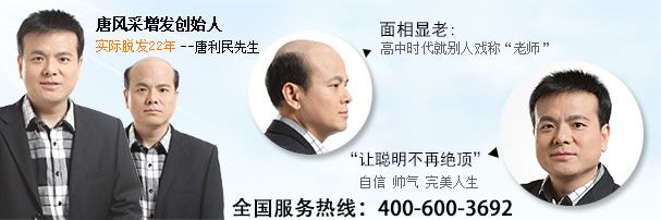 四十多歲開(kāi)始謝頂，小編為你講述一位謝頂老爸的煩惱