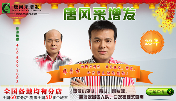 明星也織發(fā)，織發(fā)哪個(gè)牌子好？