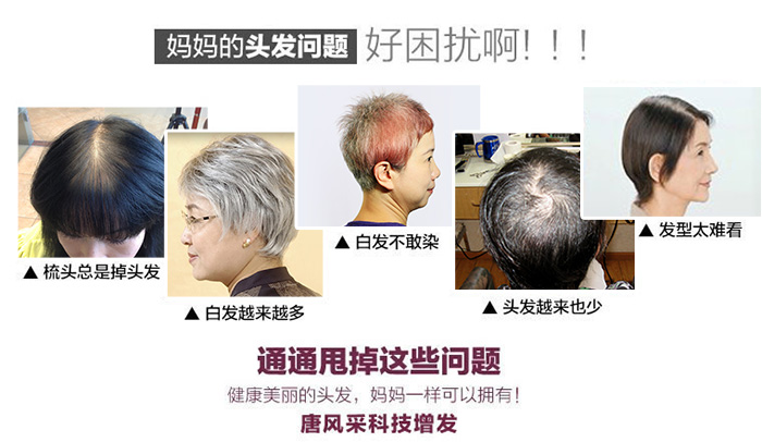 早禿怎么辦？這一招你試了嗎？