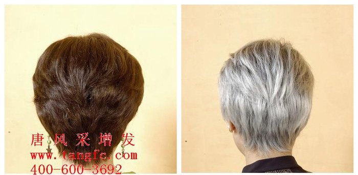 頭發(fā)過(guò)早變白怎么辦？新技術(shù)讓你白發(fā)無(wú)憂