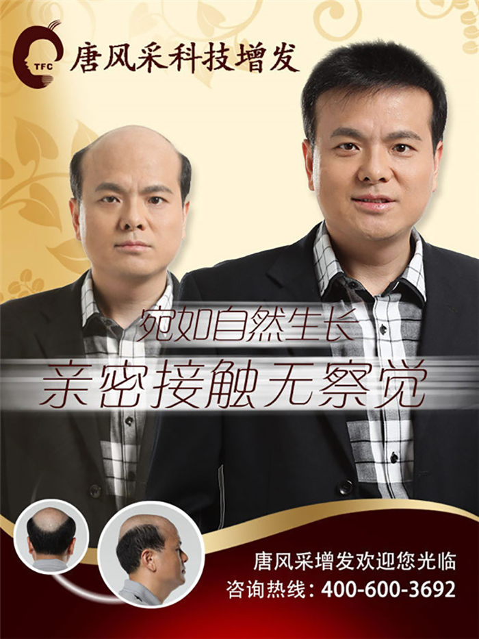 真頭發(fā)假發(fā)為什么這么受歡迎？