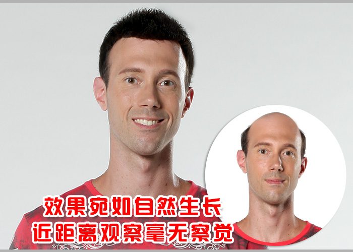 一組男士假發(fā)圖片告訴你，男士假發(fā)哪個牌子好？