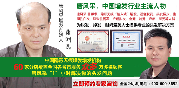 大連自然織發(fā)找哪家好？脫發(fā)復(fù)原就靠這個(gè)了！