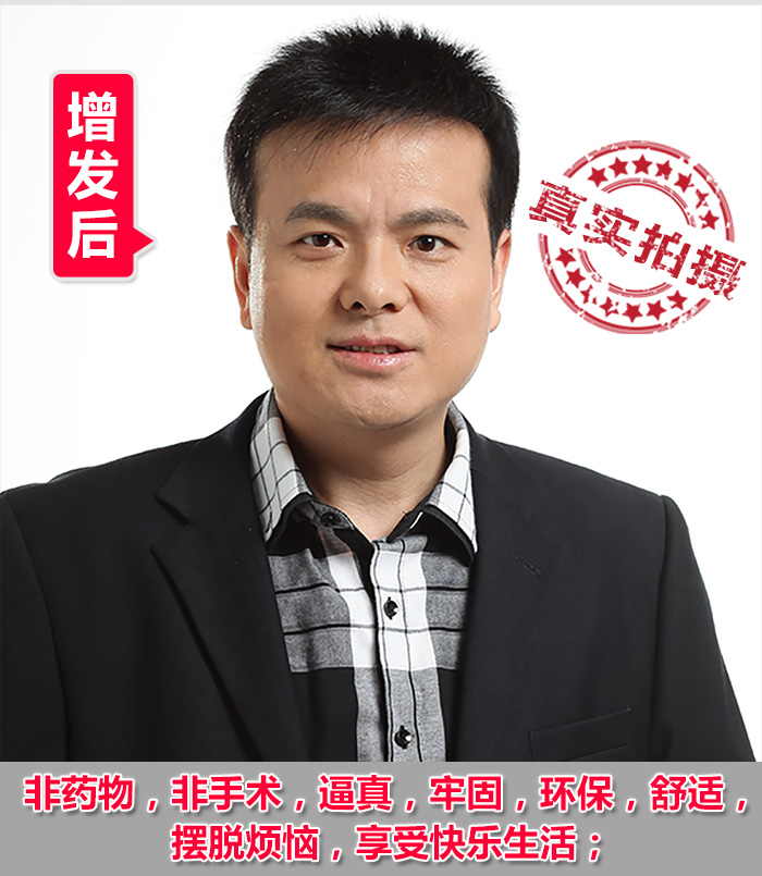 織發(fā)補(bǔ)發(fā)達(dá)人分享：紹興專業(yè)織發(fā)補(bǔ)發(fā)帶給您不一樣的體驗(yàn)