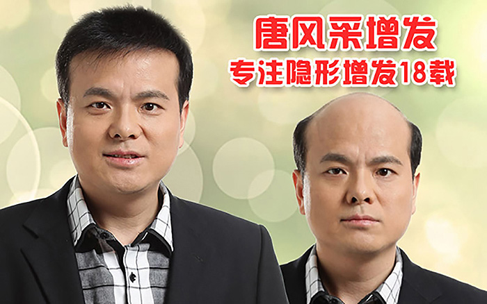 哪種男士發(fā)型好看？掉頭發(fā)怎么辦