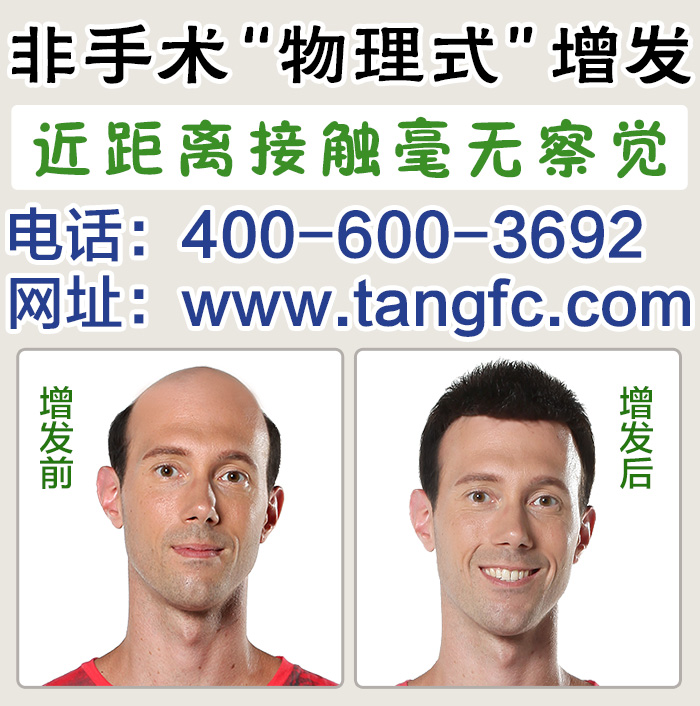 游戲男別為頭發(fā)困擾，唐風(fēng)采上海補(bǔ)發(fā)機(jī)構(gòu)為您解決問題！