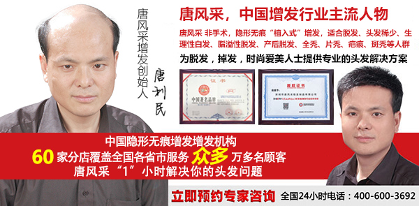 傳統(tǒng)男士假發(fā)套和補(bǔ)發(fā)的區(qū)別，長期戴哪種更好？