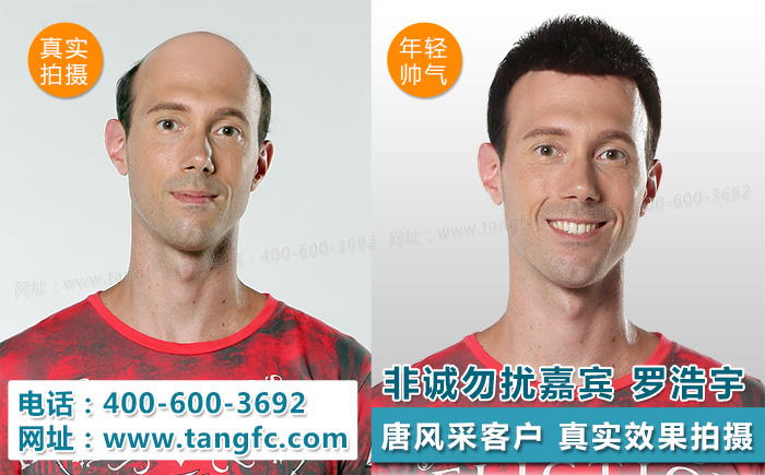 拯救你的發(fā)際線，張若昀的假發(fā)片梗你知道么？