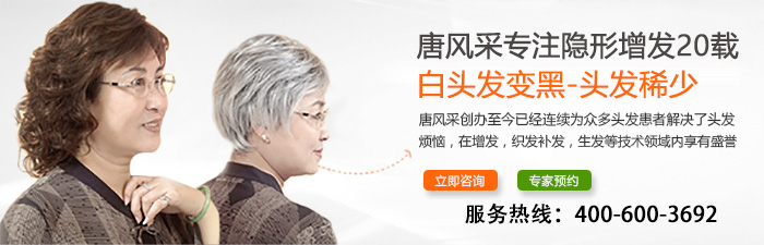 白發(fā)女士請注意，長期染發(fā)不可取，愛美就選織發(fā)補發(fā)