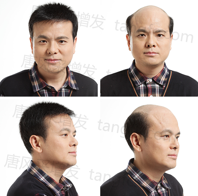 北京哪里有賣假發(fā)的？質(zhì)量好的要去哪里買？