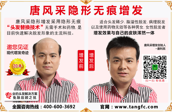 從少白頭到脫發(fā)，中年人的唐風(fēng)采假發(fā)感悟