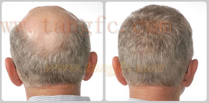 嘉興織發(fā)補(bǔ)發(fā)中心，唐風(fēng)采專業(yè)補(bǔ)發(fā)塑造完美形象！