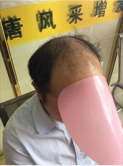 沒有對比就沒有傷害，唐風(fēng)采假發(fā)品質(zhì)看得見！