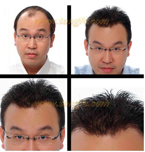 哪家假發(fā)適合脫發(fā)人？金華哪里有假發(fā)專(zhuān)賣(mài)店？