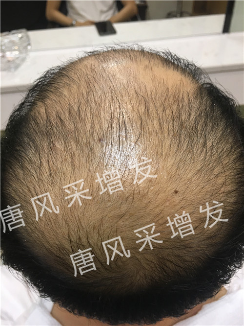 今天咱不看廣告宣傳了，唐風(fēng)采真實(shí)效果，上圖上視頻