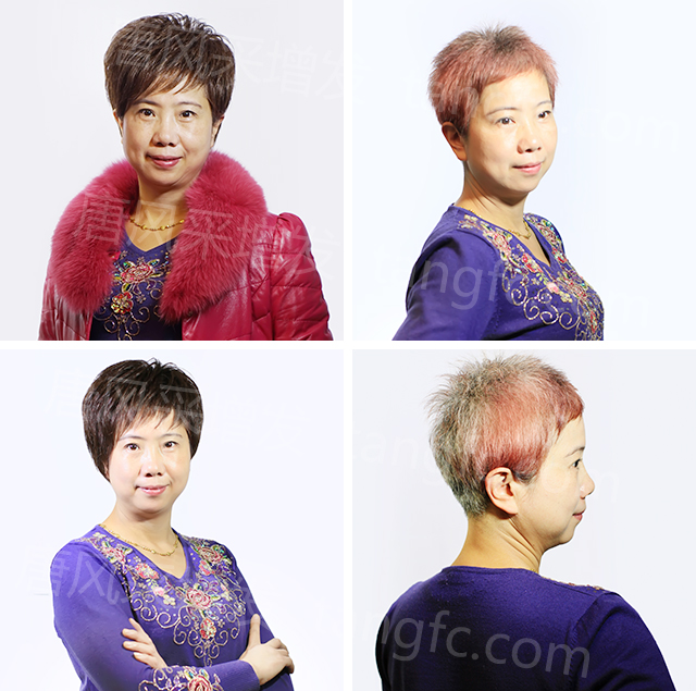 柳州織發(fā)假發(fā)訂做，效果杠杠不負(fù)好時(shí)光！