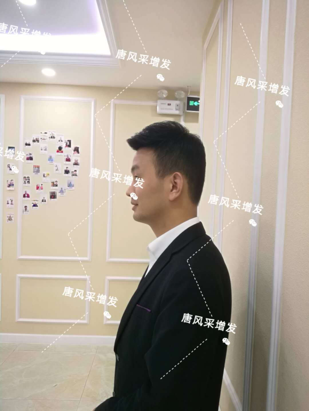 輸了頭發(fā)不能輸氣質(zhì)，看帥哥的逆襲之路！