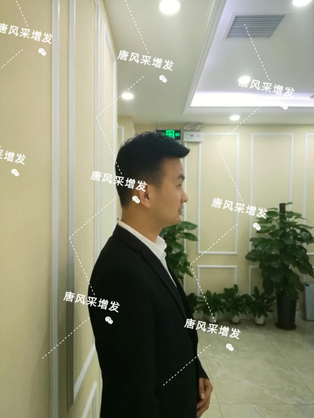 輸了頭發(fā)不能輸氣質(zhì)，看帥哥的逆襲之路！