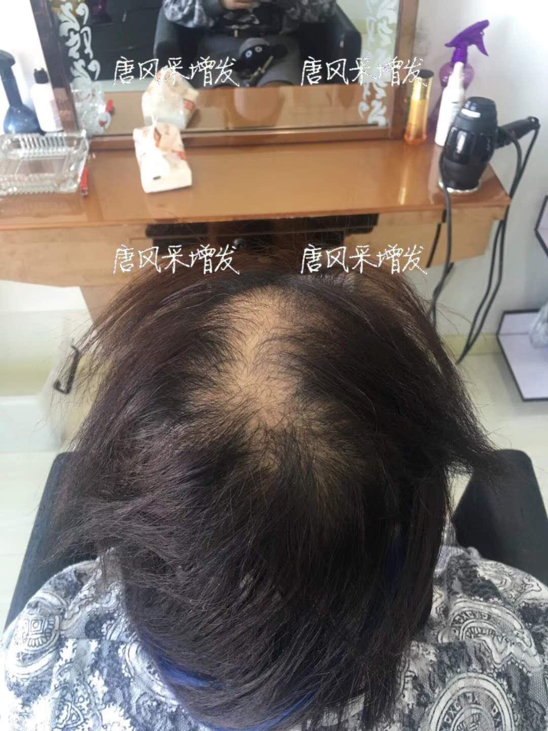  生發(fā)了這么久，但凡有效果的也該有些跡象了