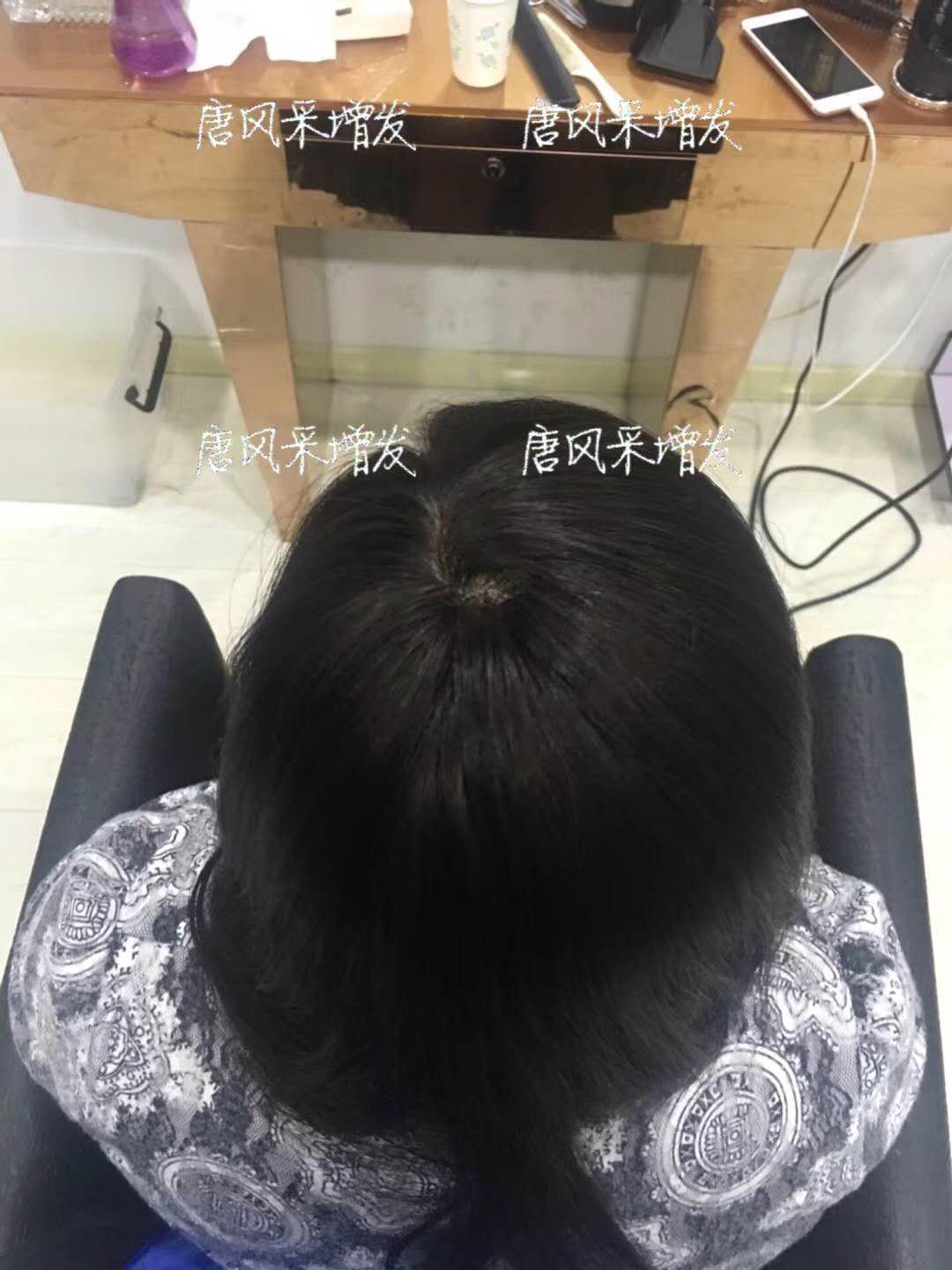 生發(fā)了這么久，但凡有效果的也該有些跡象了