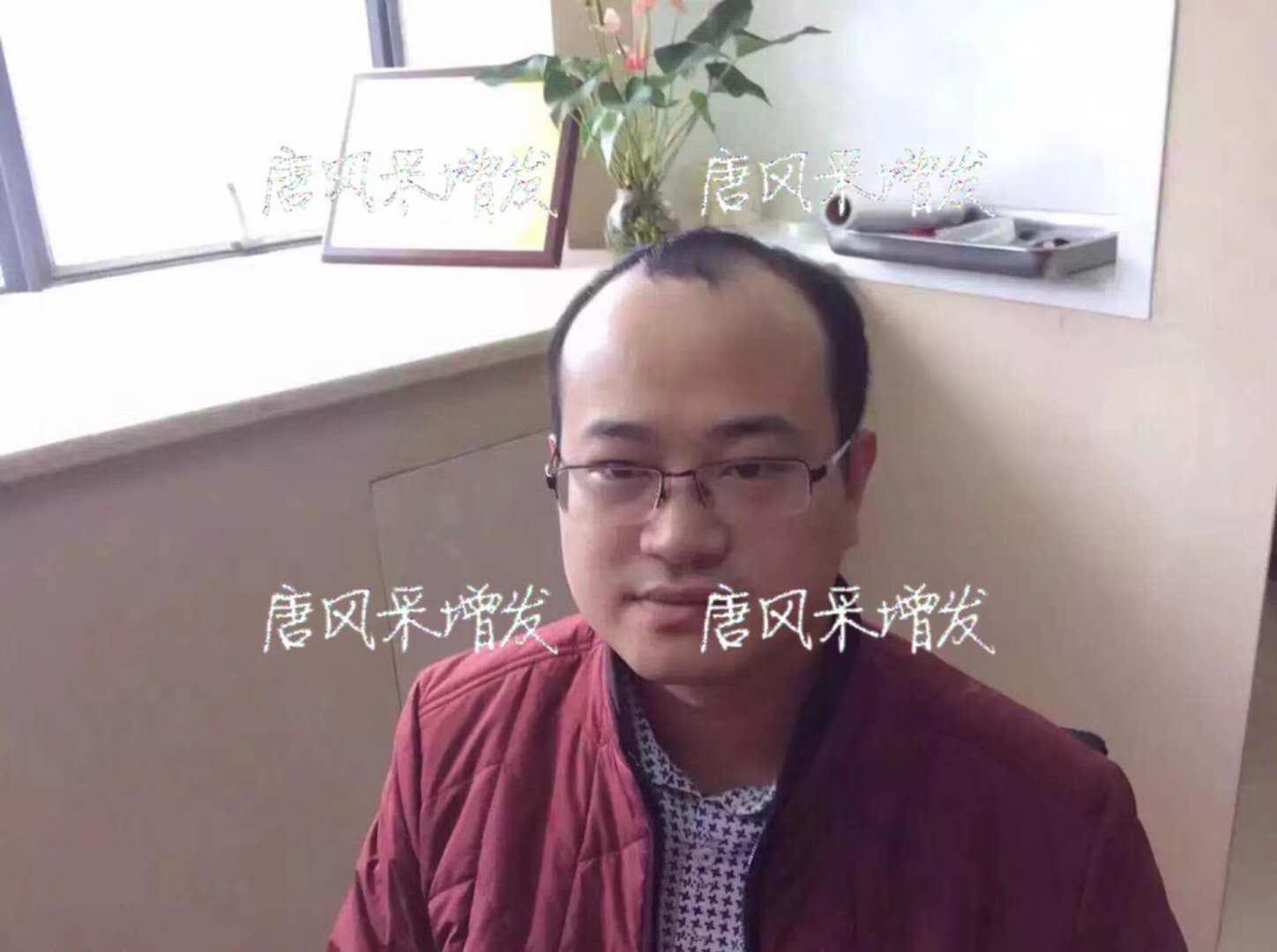  生發(fā)了這么久，但凡有效果的也該有些跡象了