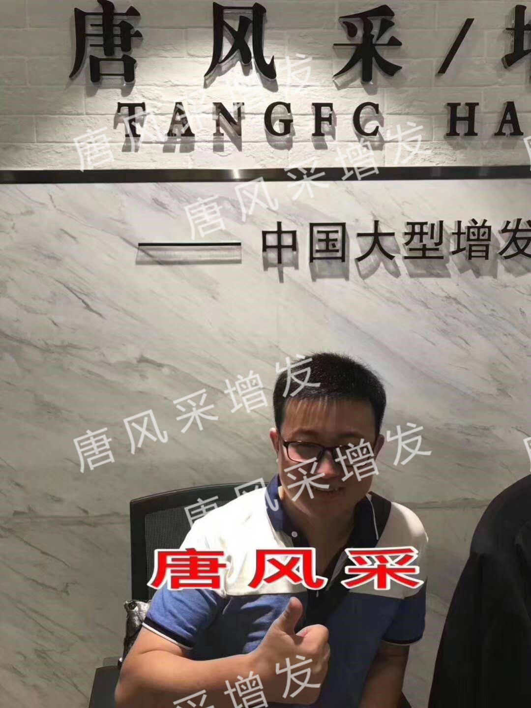 貧窮限制了想象，禿頂限制了造型？