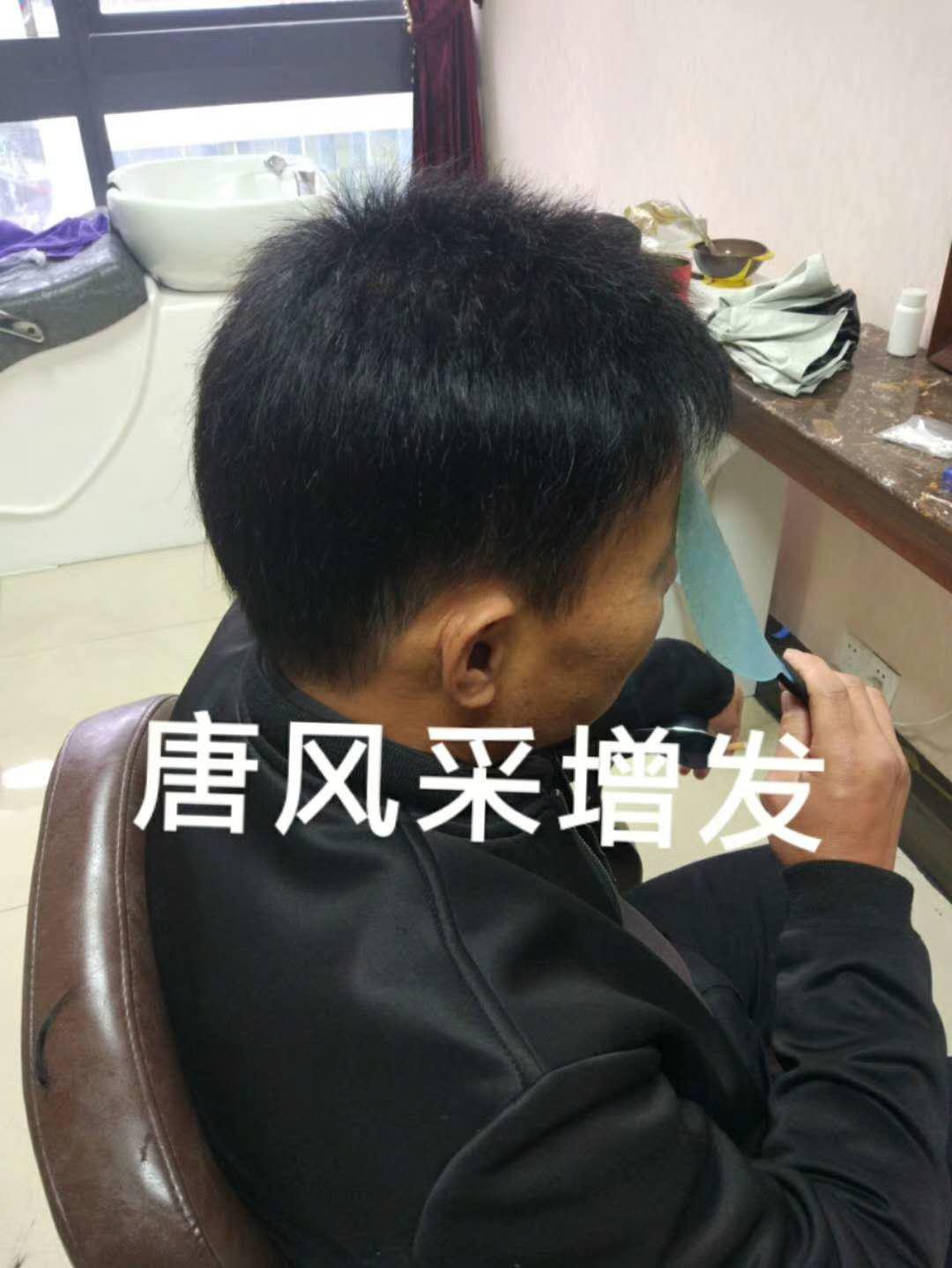 脫發(fā)謝頂壓力大，增發(fā)補(bǔ)發(fā)一身輕！