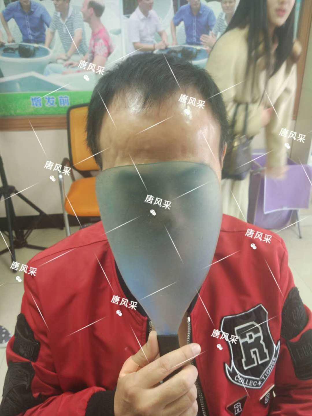 有頭發(fā)和沒頭發(fā)之間的巨大差距，看完你就明白了！