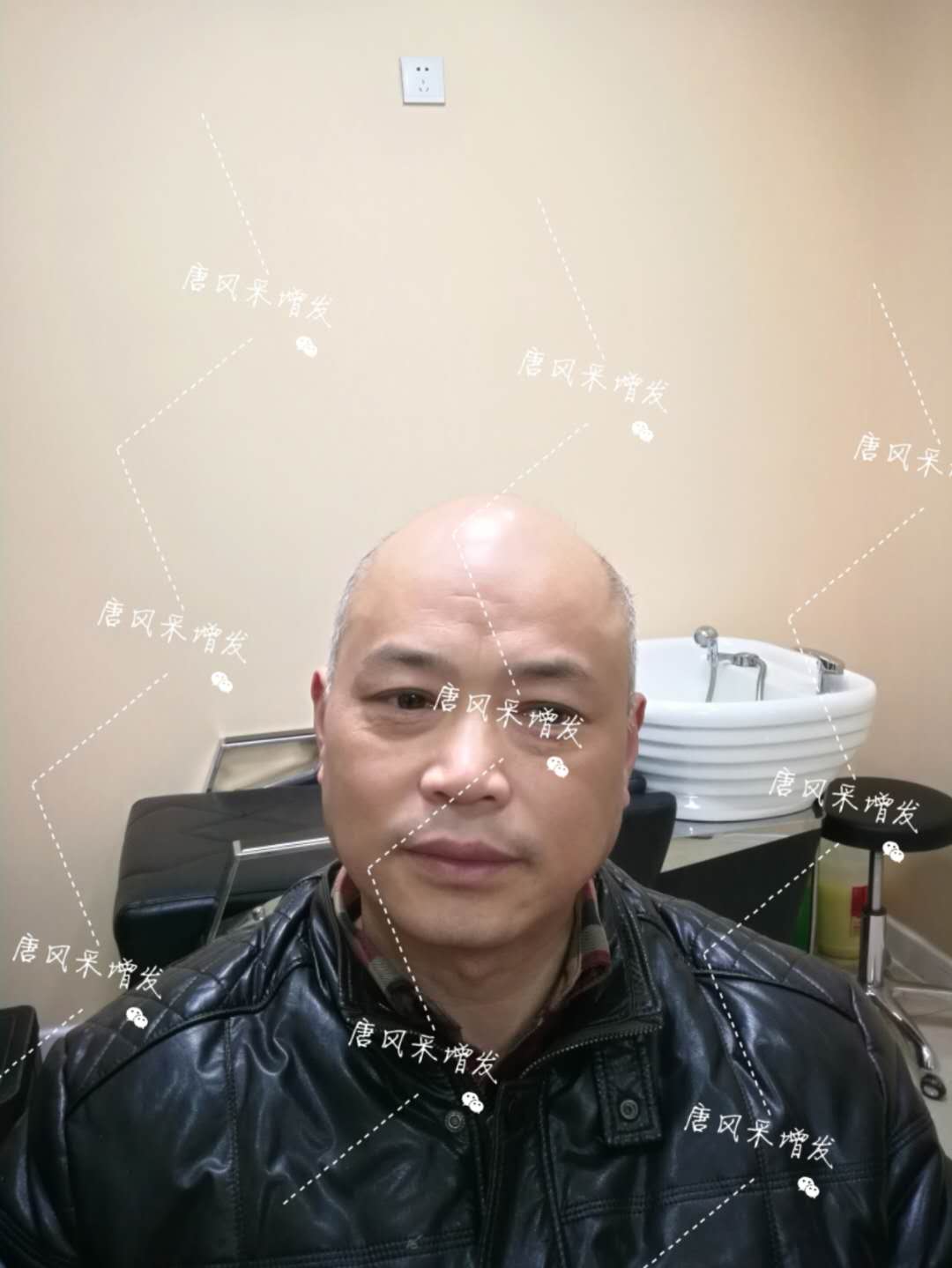 我的天吶！沒想到某防脫洗發(fā)水的老板居然也脫發(fā)了！