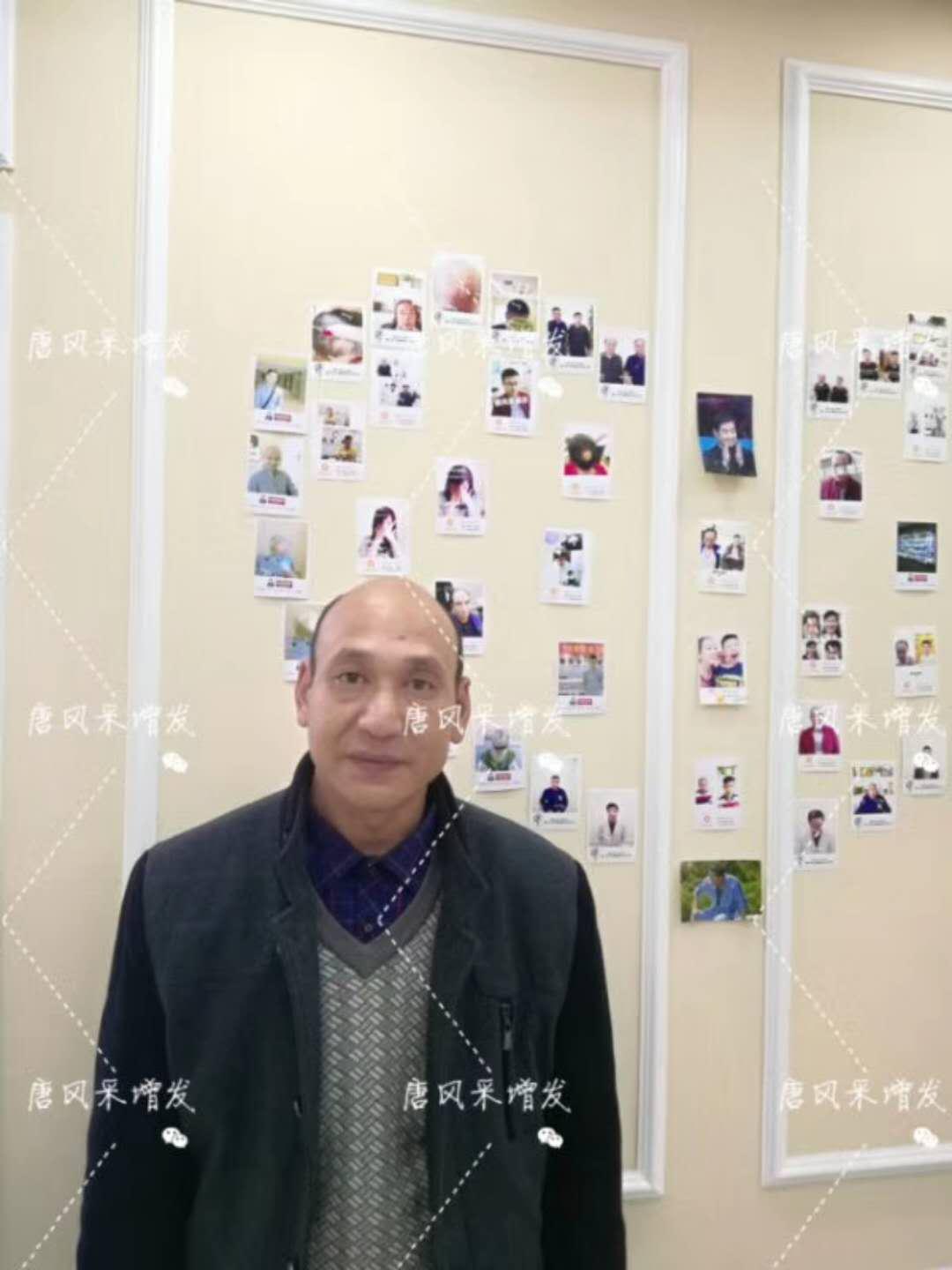 我的天吶！沒想到某防脫洗發(fā)水的老板居然也脫發(fā)了！